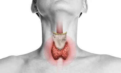 L’hypothyroïdie : comprendre un trouble hormonal fréquent